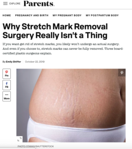 Stretch Marks Reduction