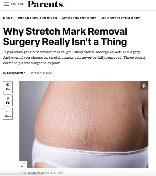 Can Yoga Help Reverse Stretch Marks? - Plastic Surgery Skin Clinic