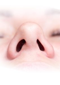 Figure 14. Pinched nasal tip, proximal view.