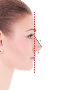 Goode Method assessment for nasal tip projection ratio.