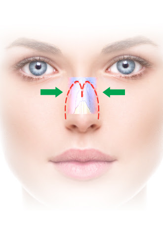 nasal bones