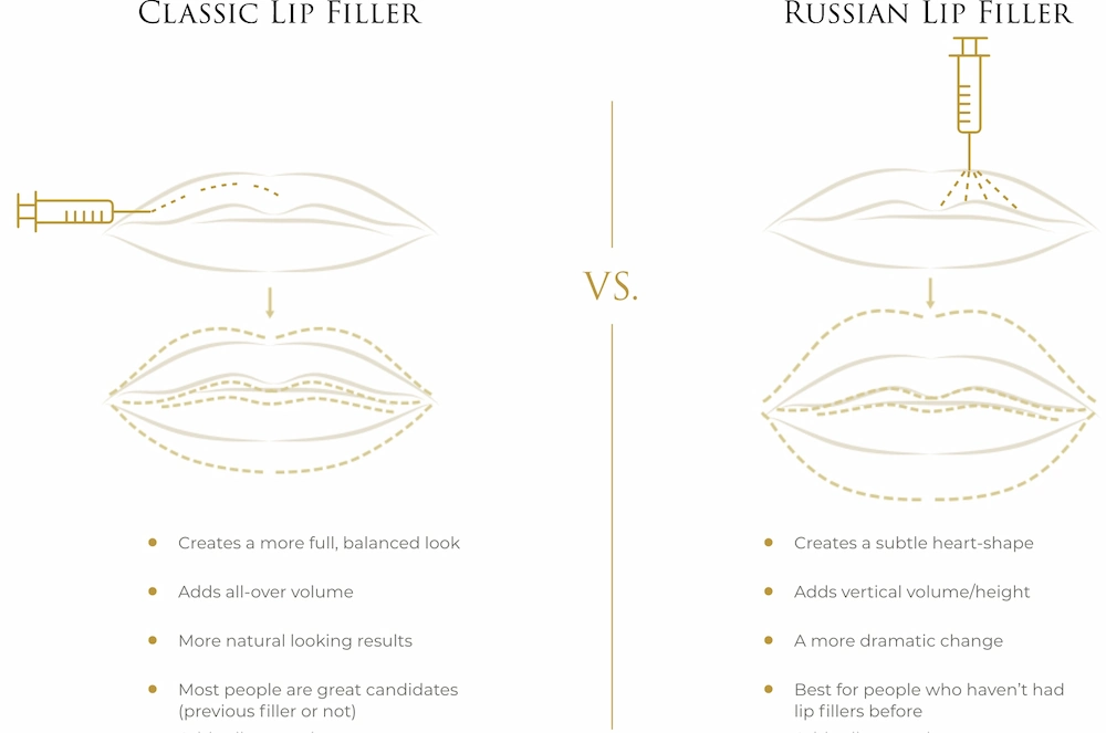 Lip Fillers Techniques, anatomy, injections, cost