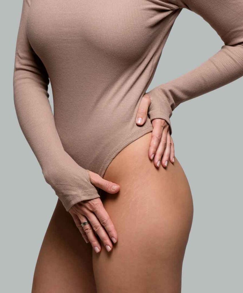 womans-thighs