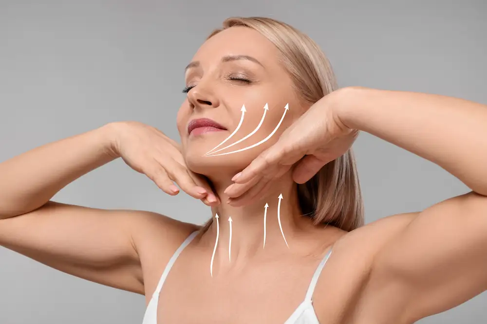 facelift diagram